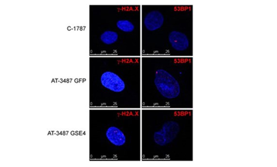 Logran atenuar los efectos patológicos en células de pacientes de ataxia telangiectasia con el péptido GSE4