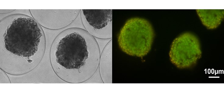 tratamiento de la diabetes nueva investigación