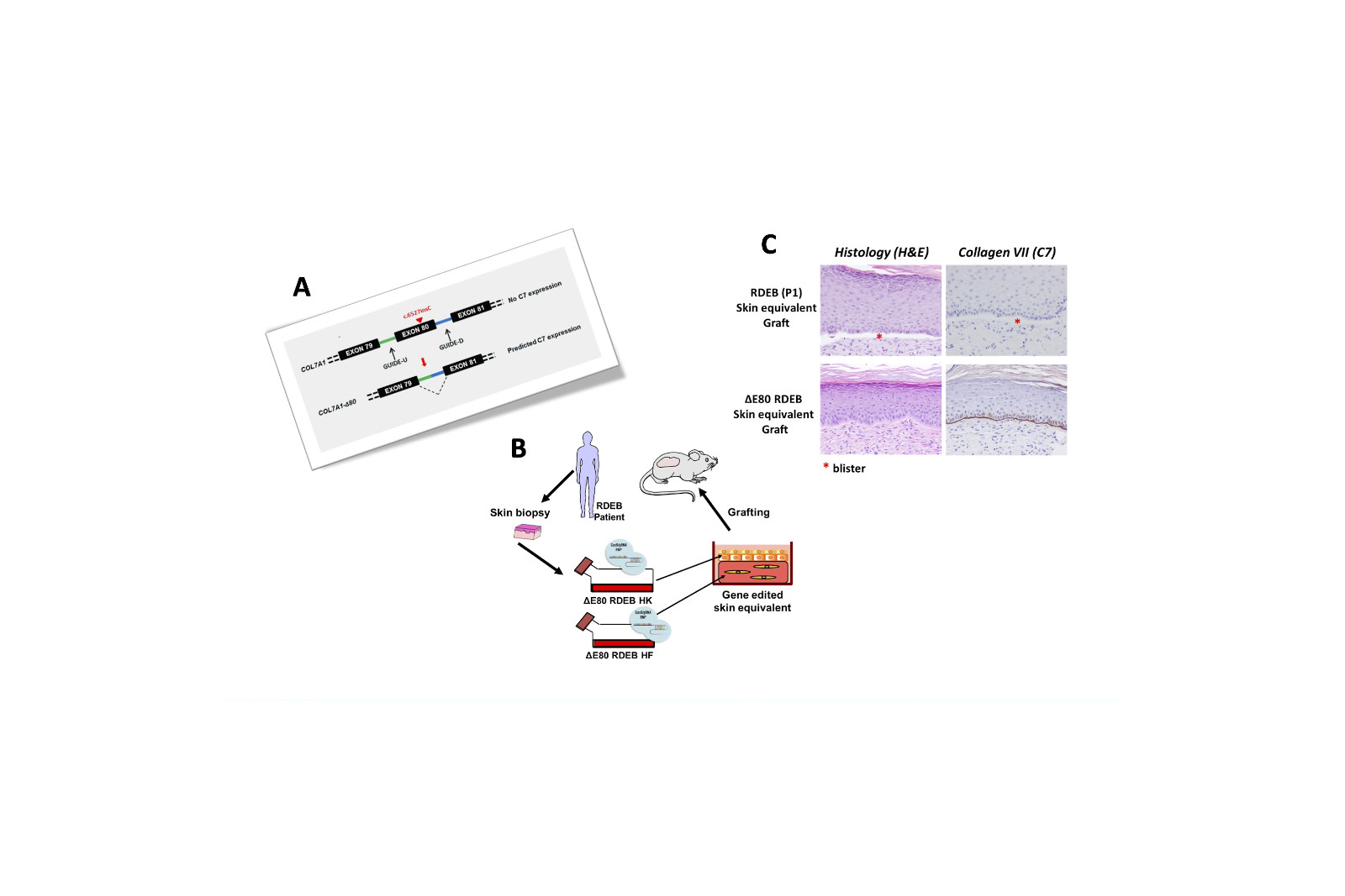 Un producto de terapias avanzadas que combina edición genómica y bioingeniería tisular, designado medicamento huérfano para la piel de mariposa
