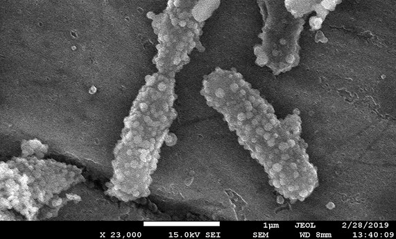 Bacterias para transportar nanopartículas cargadas con fármacos a tejidos tumorales
