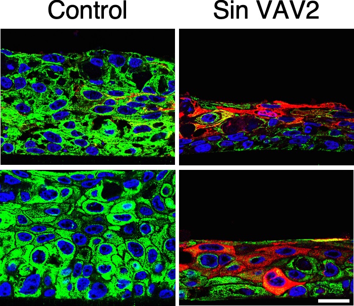 Un estudio identifica moléculas clave para el desarrollo y evolución de propiedades malignas de los cánceres de cabeza y cuello