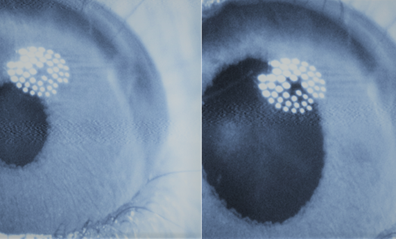 Desarrollan nuevas moléculas que permiten dilatar la pupila con luz