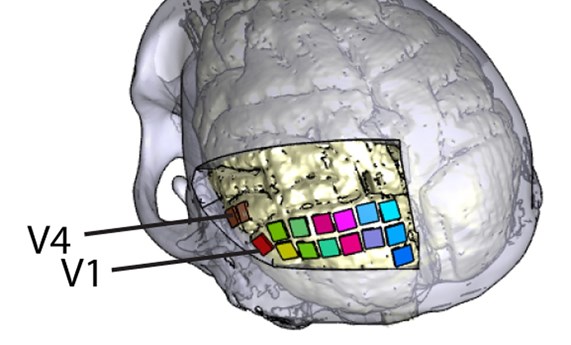 Desarrollado un nuevo implante cerebral con electrodos que podría ayudar a personas ciegas a percibir formas y letras