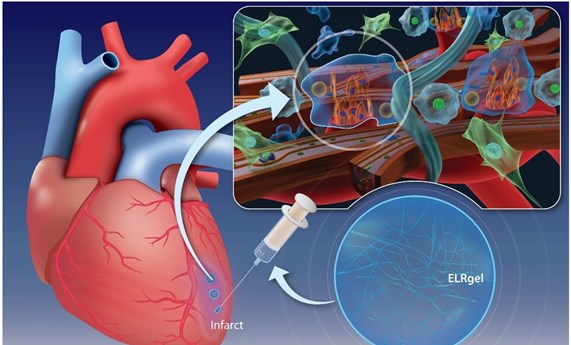 La inyección de un hidrogel puede promover la curación del músculo cardíaco después de un infarto