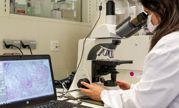 Desarrollado un nanomedicamento más eficaz para el tratamiento de la enfermedad rara de Fabry
