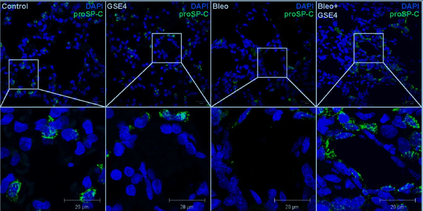 Logran revertir la fibrosis pulmonar en modelos murinos con nanopartículas cargadas con un péptido