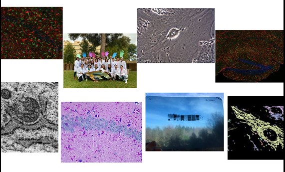 Abierta la votación del público del 3º Concurso CIBERER de fotografía sobre investigación en enfermedades raras