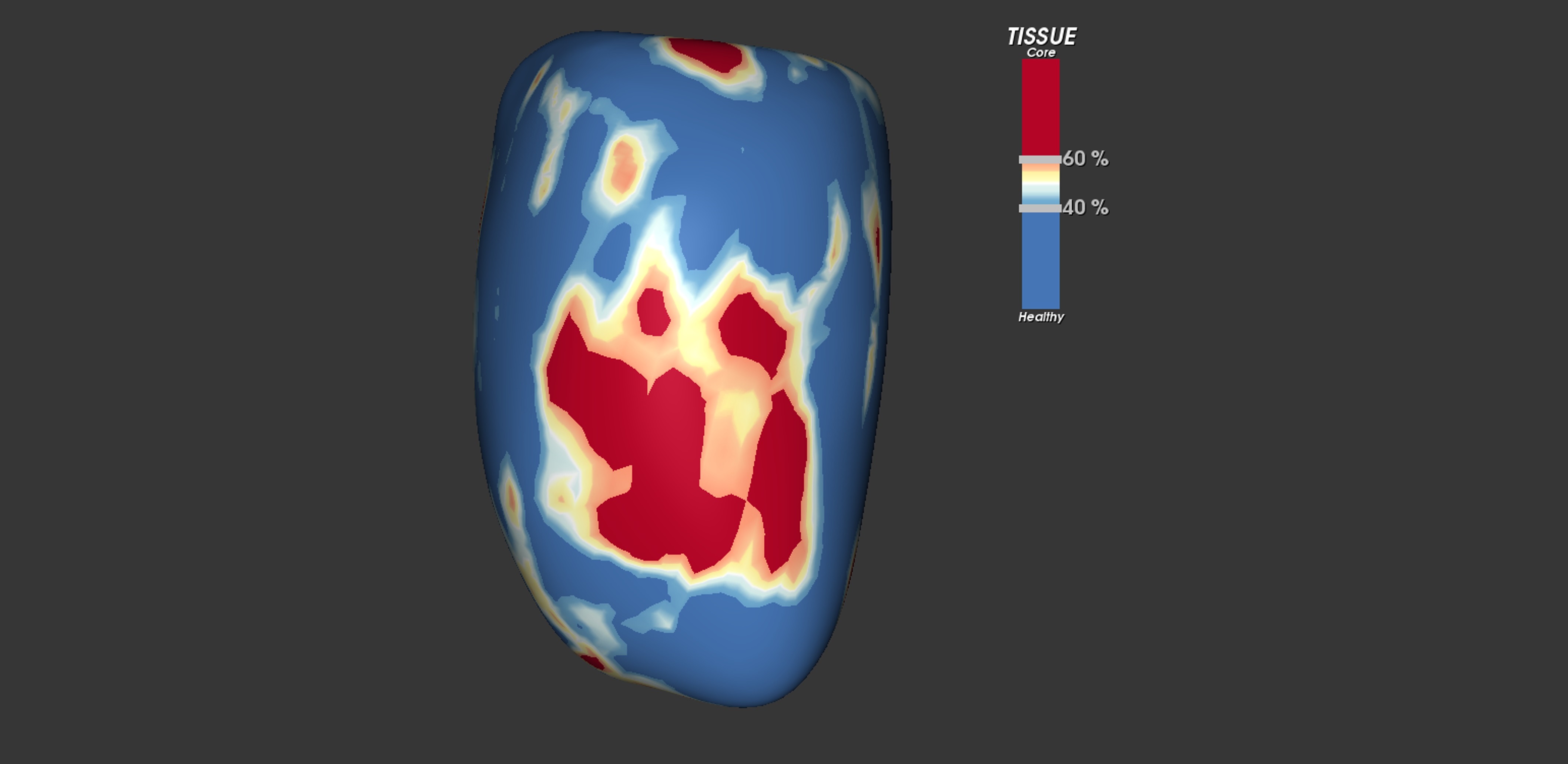 El estudio CIBER-SPANISH 1 comienza la inclusión del primer paciente