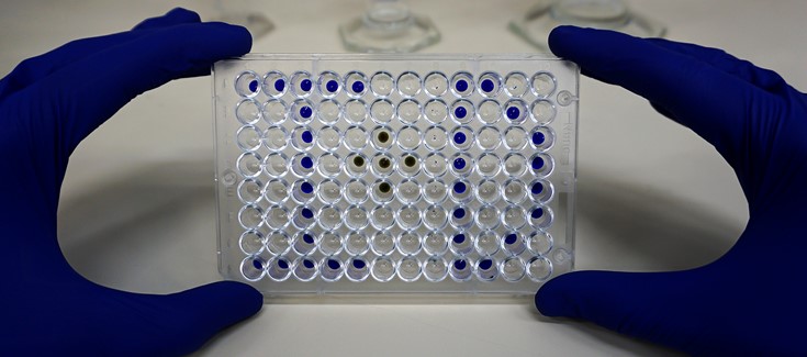 CIBERER lanza la convocatoria anual de Acciones Cooperativas y Complementarias Intramurales (ACCI) 2024