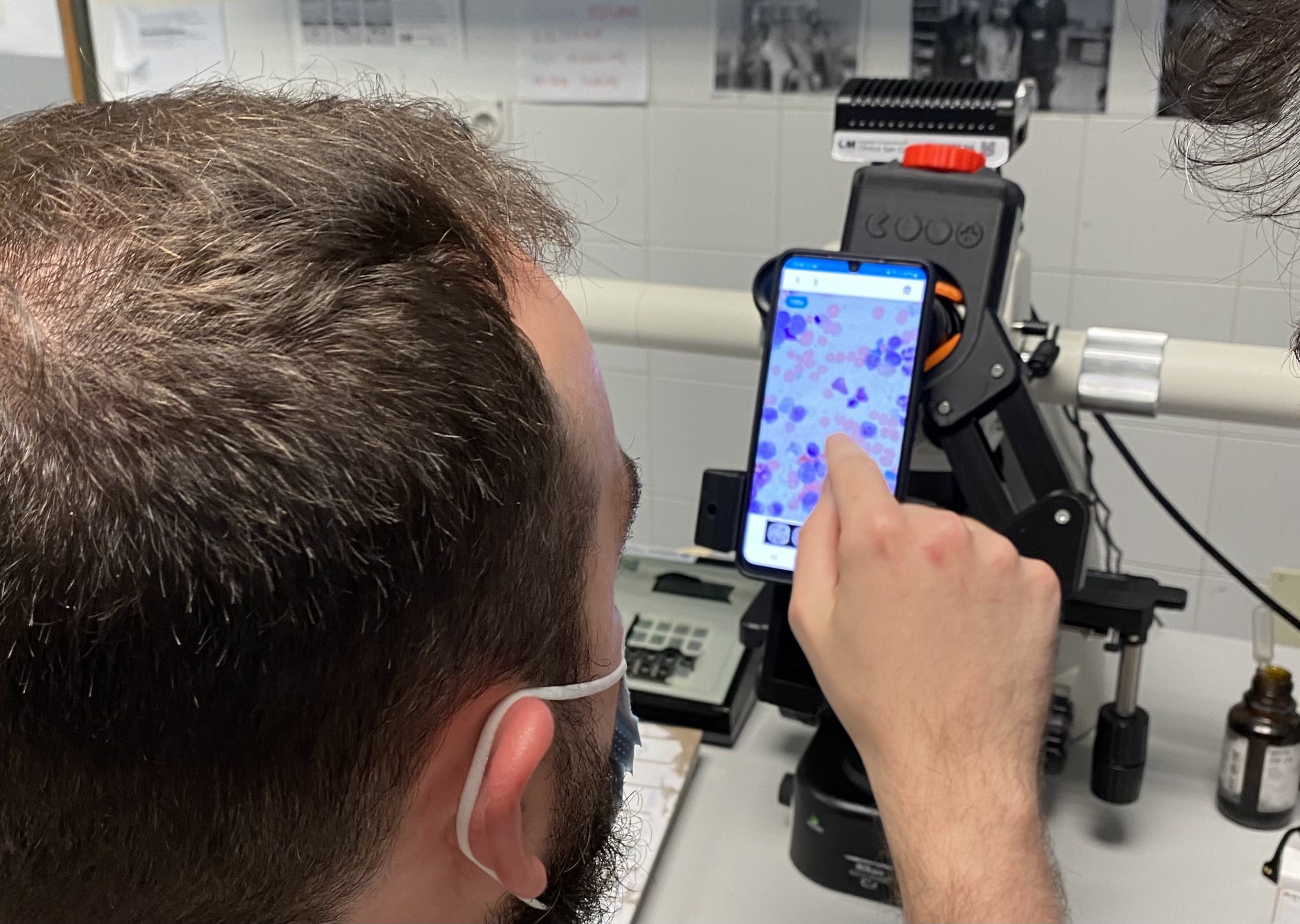 Inteligencia artificial para ayudar a diagnosticar enfermedades hematológicas