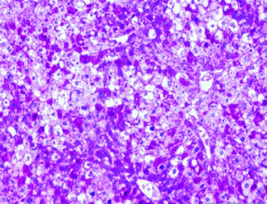 Descubren que hígado y cerebro se comunican para regular el apetito